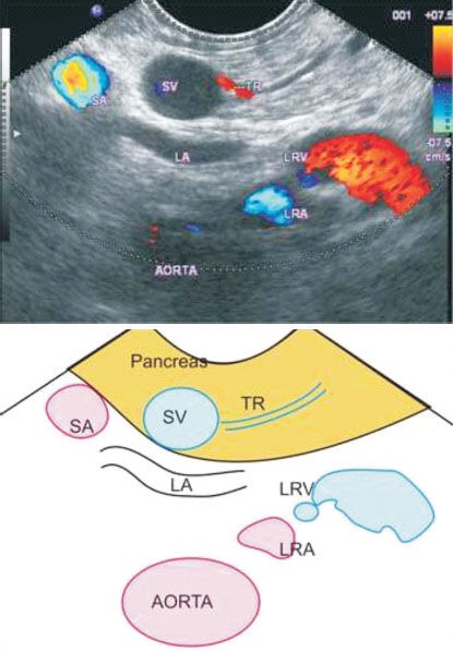 Figure 18