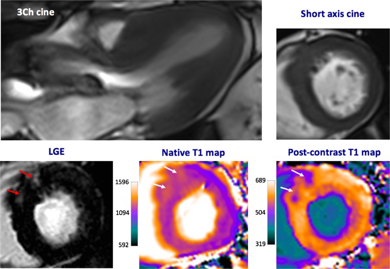 Fig. 4