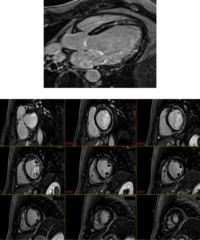 Figure 3