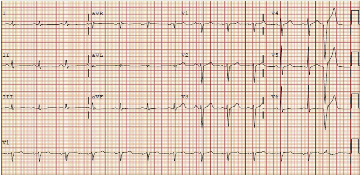 Figure 2