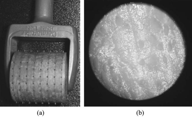 Fig. 1