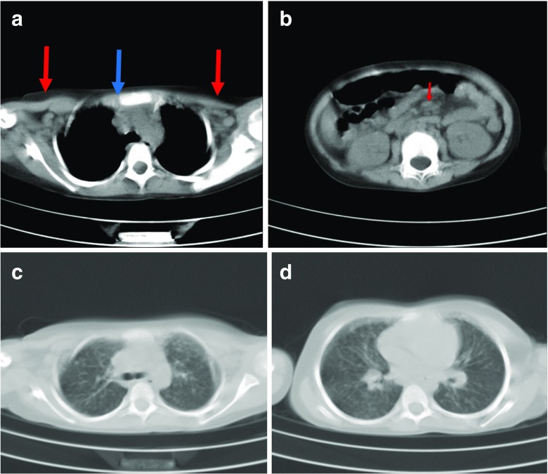 Fig. 1