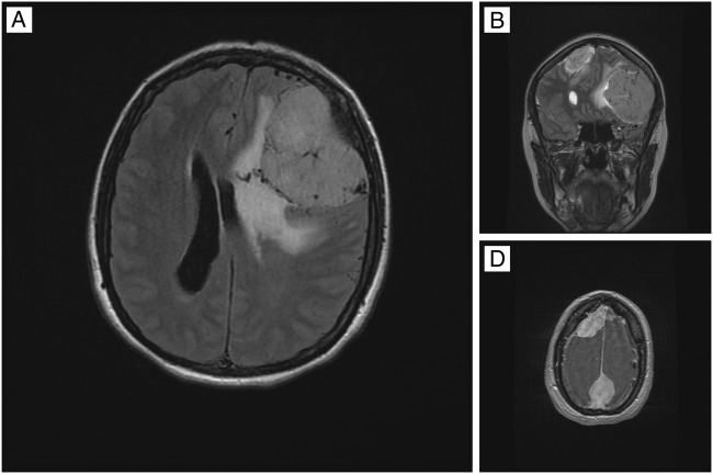 Figure 1