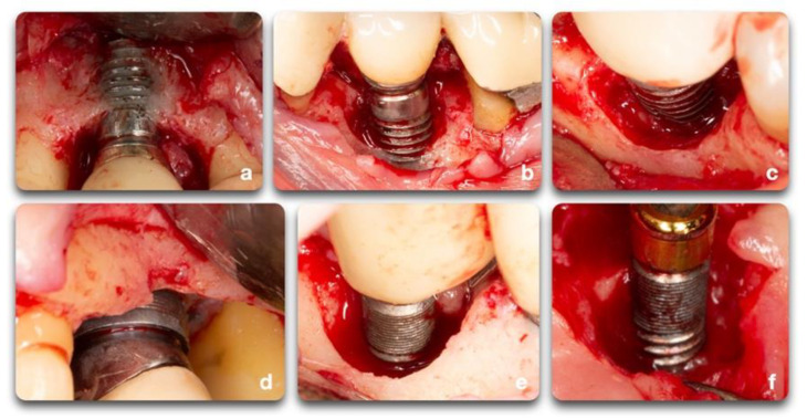 Figure 6