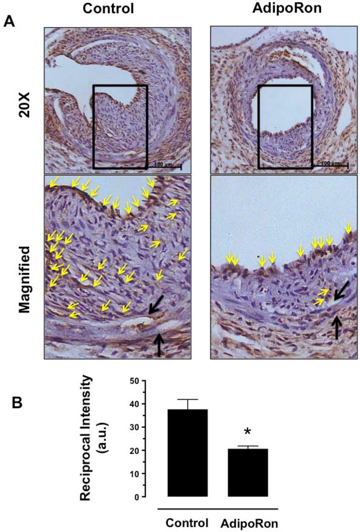 Fig. 11