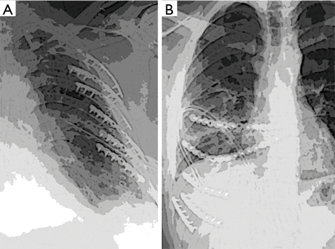 Figure 9