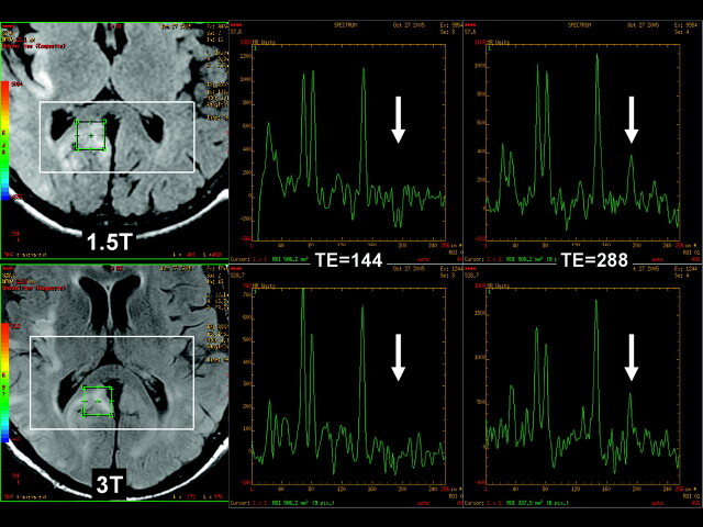 Fig 3.