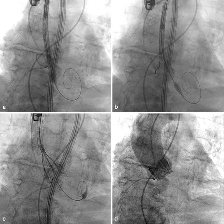 Fig. 1