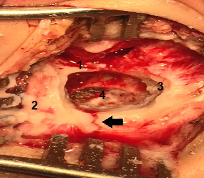 FIGURE 4