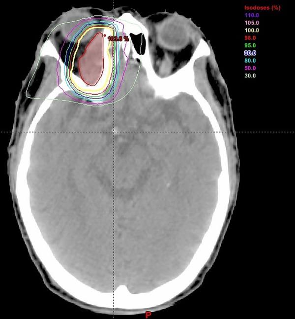 Figure 3