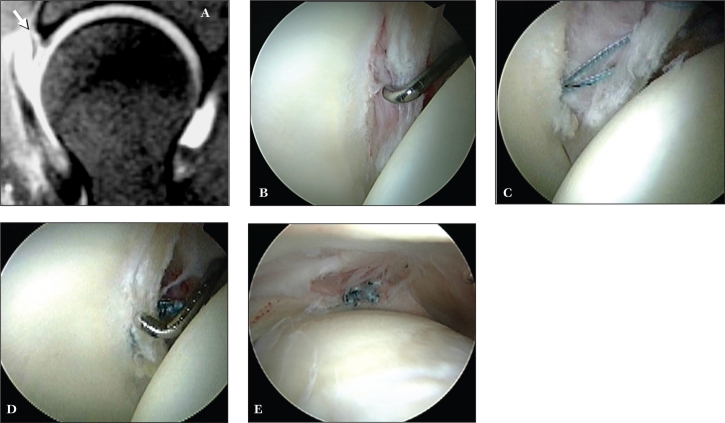 Figure 11.