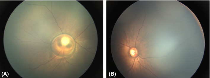 Fig. 4