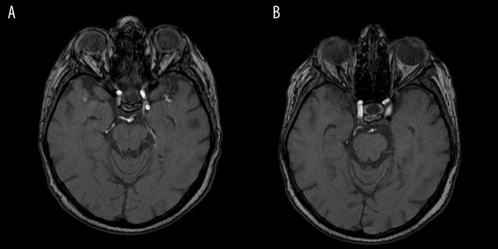 Figure 20