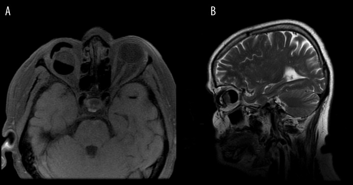 Figure 25