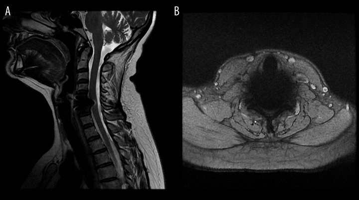 Figure 18