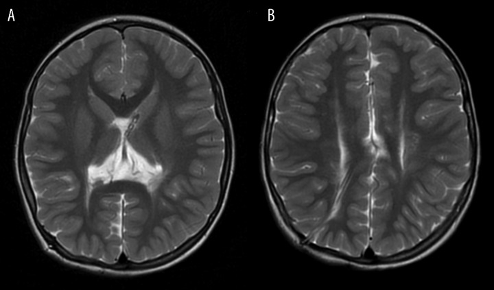 Figure 17