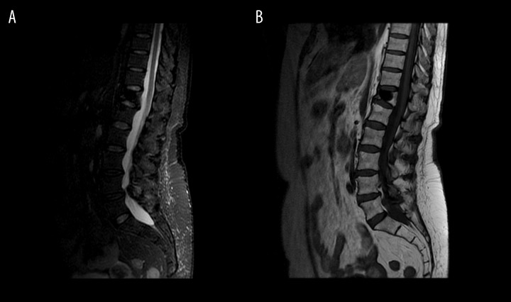 Figure 19