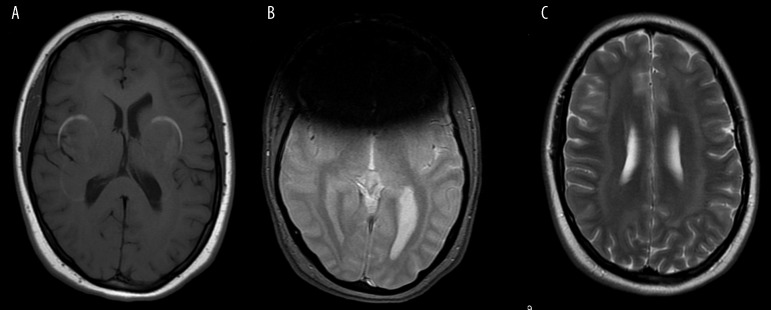 Figure 14A, B