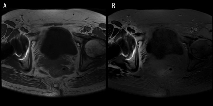 Figure 24