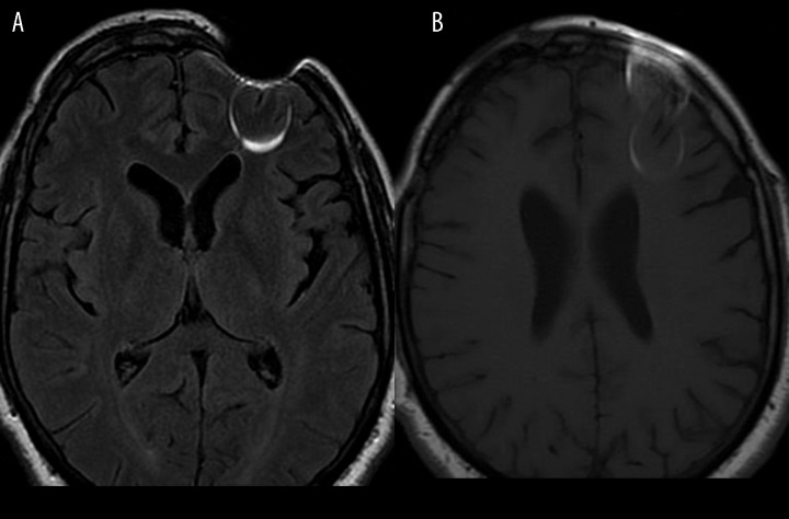 Figure 16