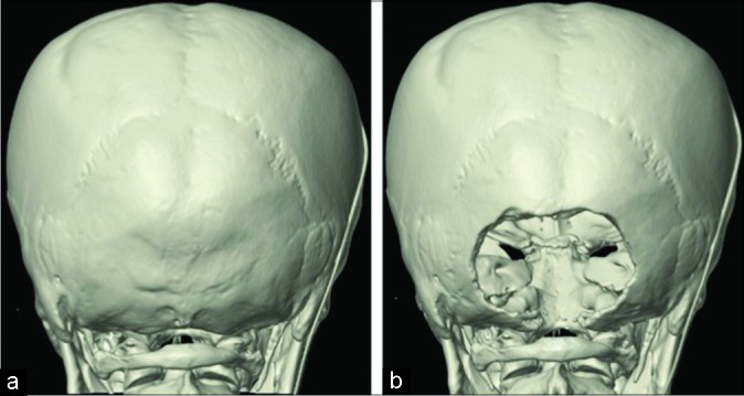 Figure 2: