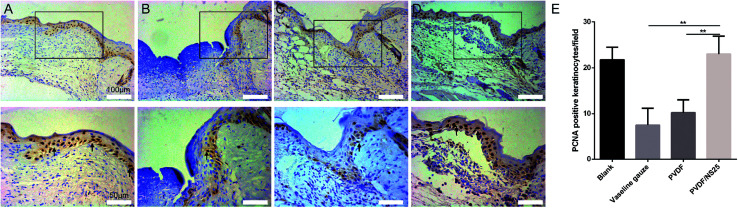 Fig. 11