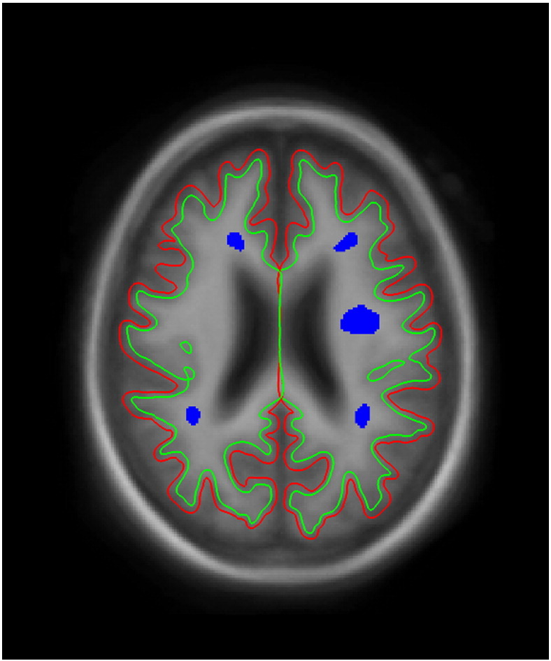 Fig. 1