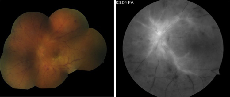 Fig. 2