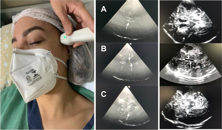 Fig. 3