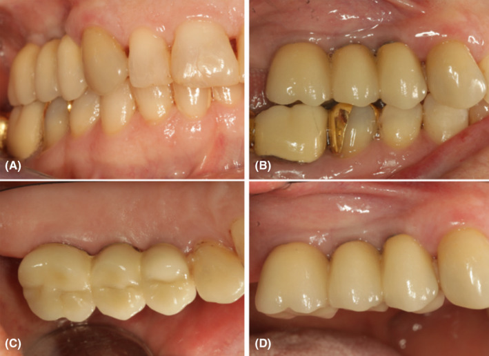 FIGURE 4