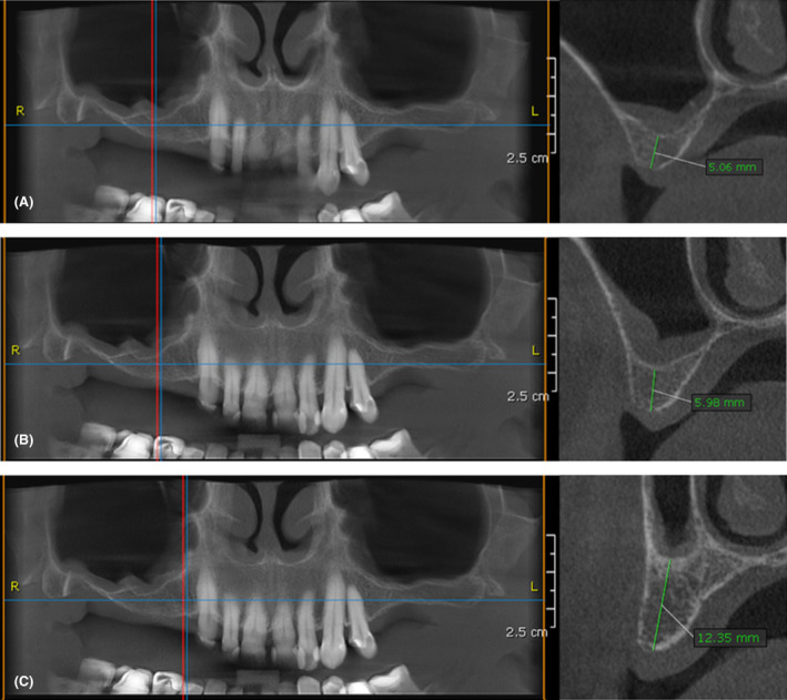 FIGURE 1