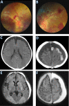 Fig. 1
