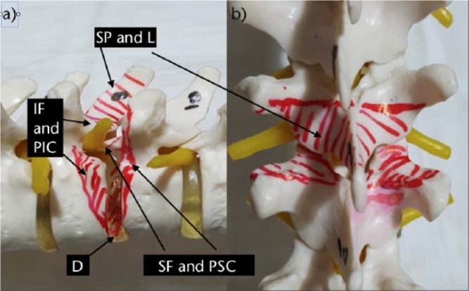 Spinal osteotomies: indications, limits and pitfalls - PMC