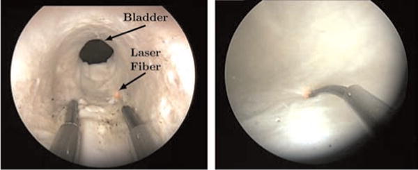 Fig. 19