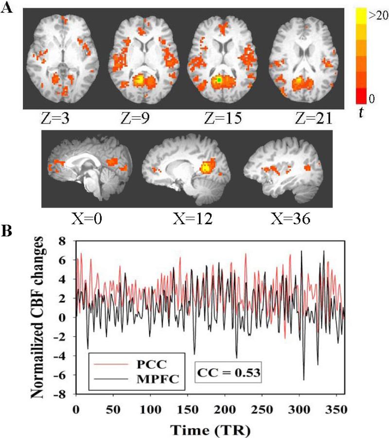 Fig. 3A