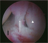 Figure 11.
