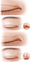 Fig. 8.