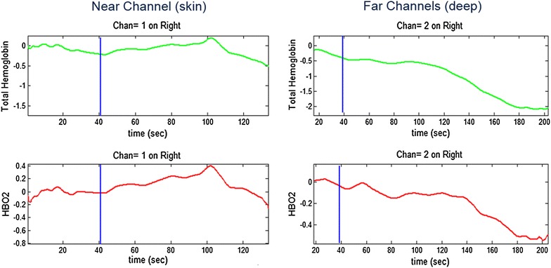 Fig. 6