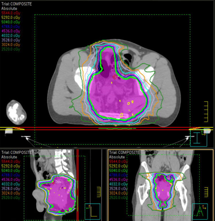 Figure 4