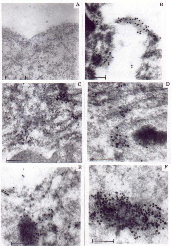 Expression of peanut agglutinin-binding mucin-type glycoprotein in ...