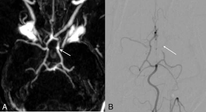 Fig 3.