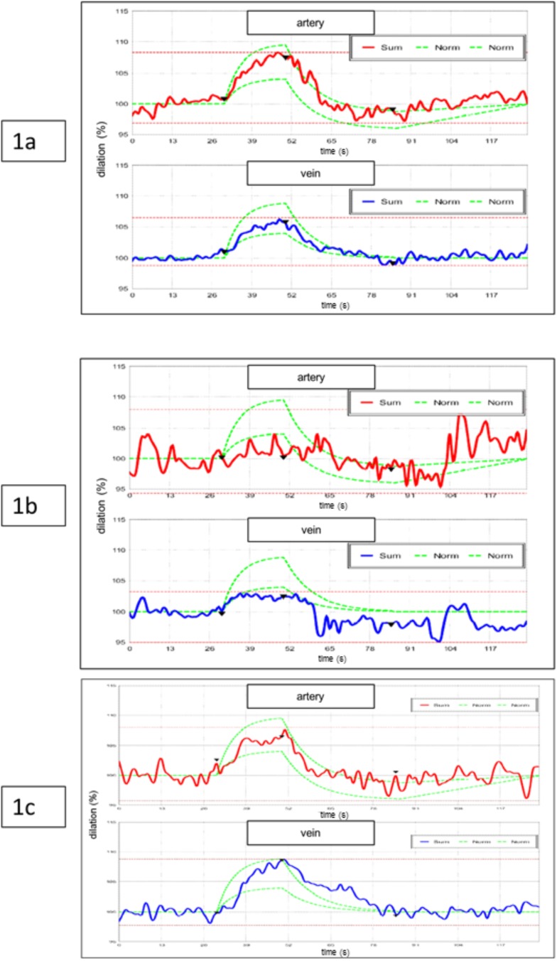 Fig. (1)