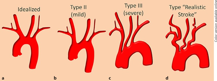 Fig. 13.