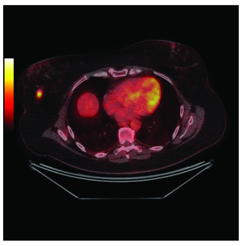 Figure 2A. 