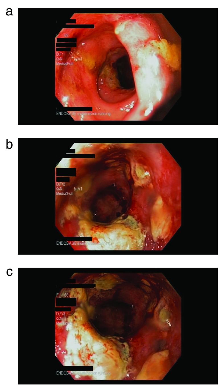 Figure 1A. 