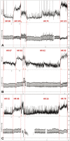 Fig. 2