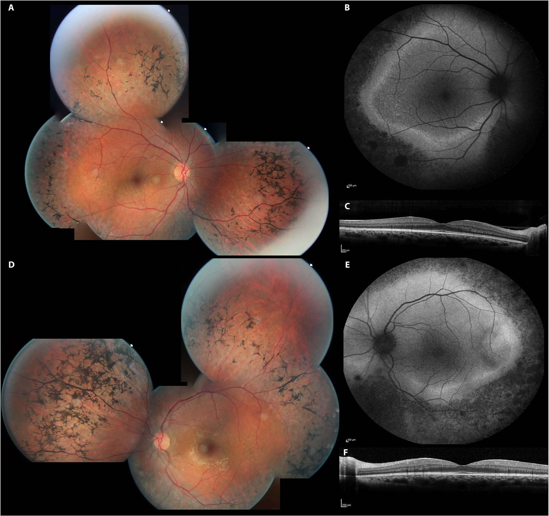 Fig 4.