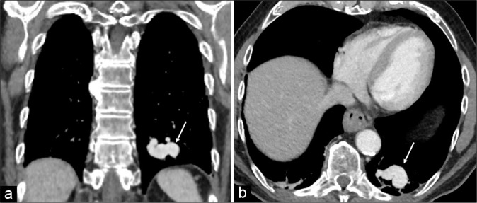 Figure 2: