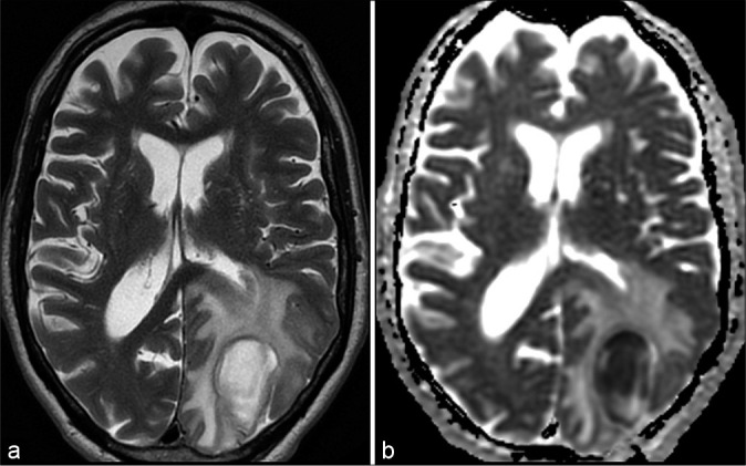 Figure 3: