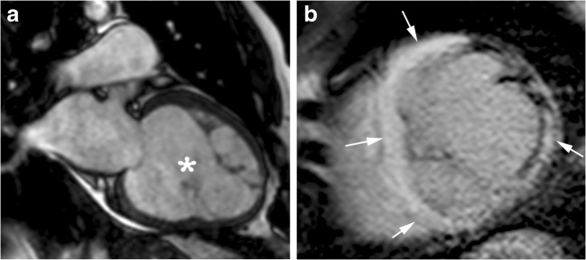 Fig. 12